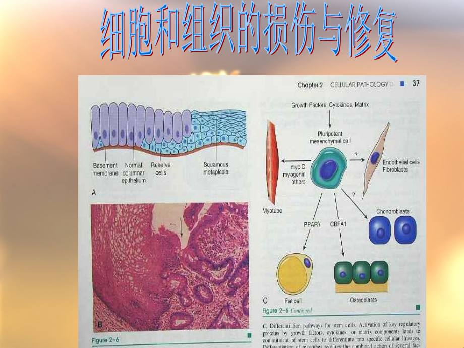 细胞和组织的损伤与修复_课件_第2页