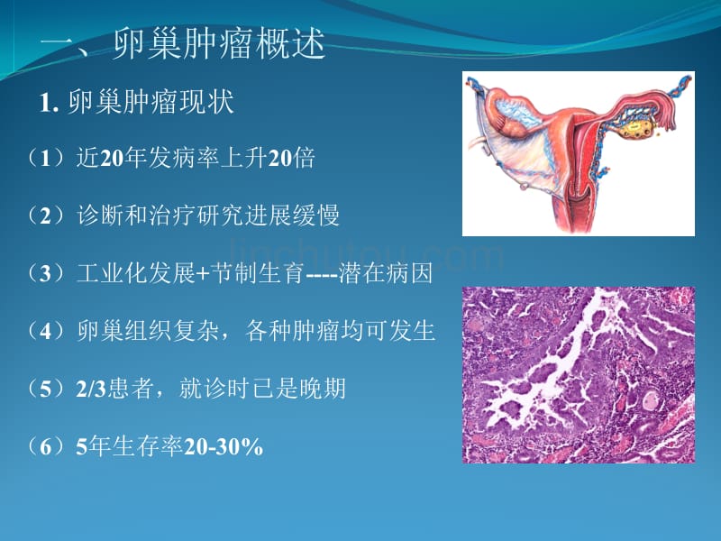 卵巢交界性肿瘤诊治进展_第3页