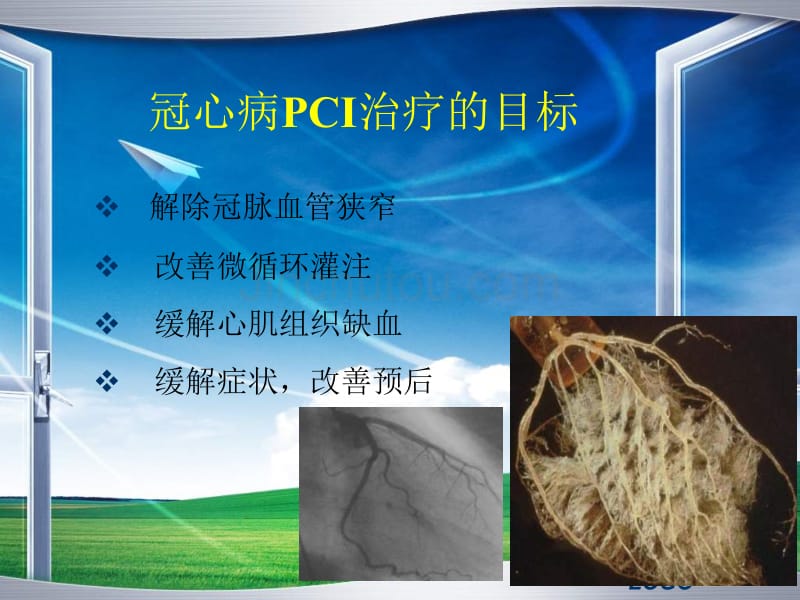 pci围术期心肌保护_第2页