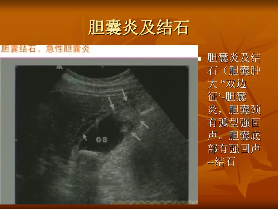 临床技能第三考站-b超-影像学课件_第4页