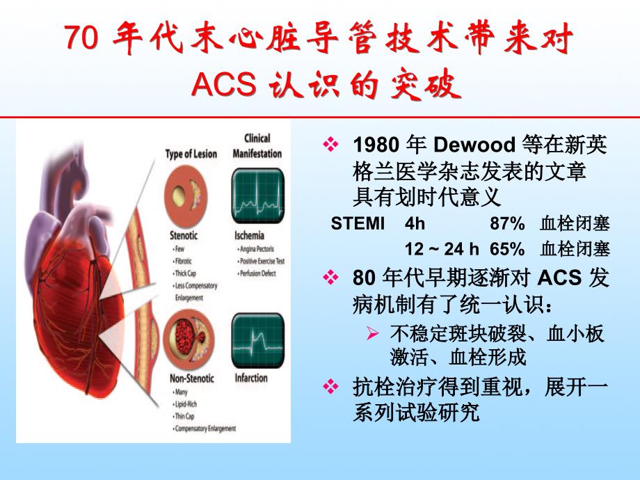 acs溶栓及抗栓治疗热点回顾_第3页