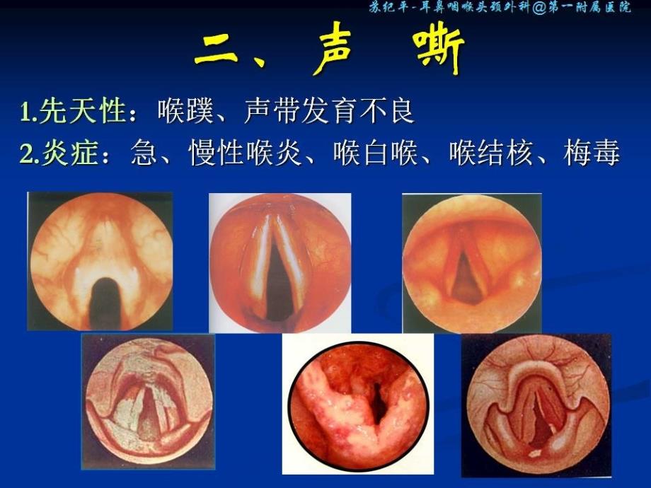 喉的症状学 耳鼻咽喉头颈外科学课件_第4页