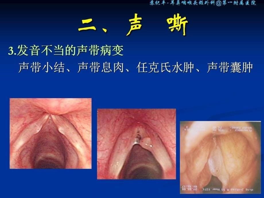 喉的症状学 耳鼻咽喉头颈外科学课件_第5页