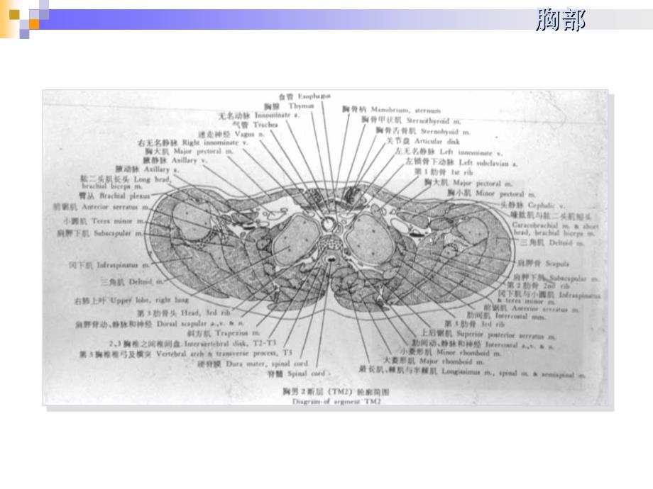 胸部断层解剖课件_第4页