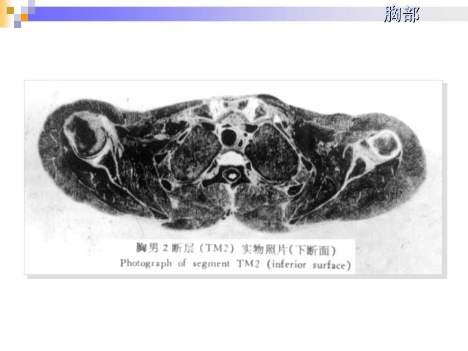 胸部断层解剖课件_第5页