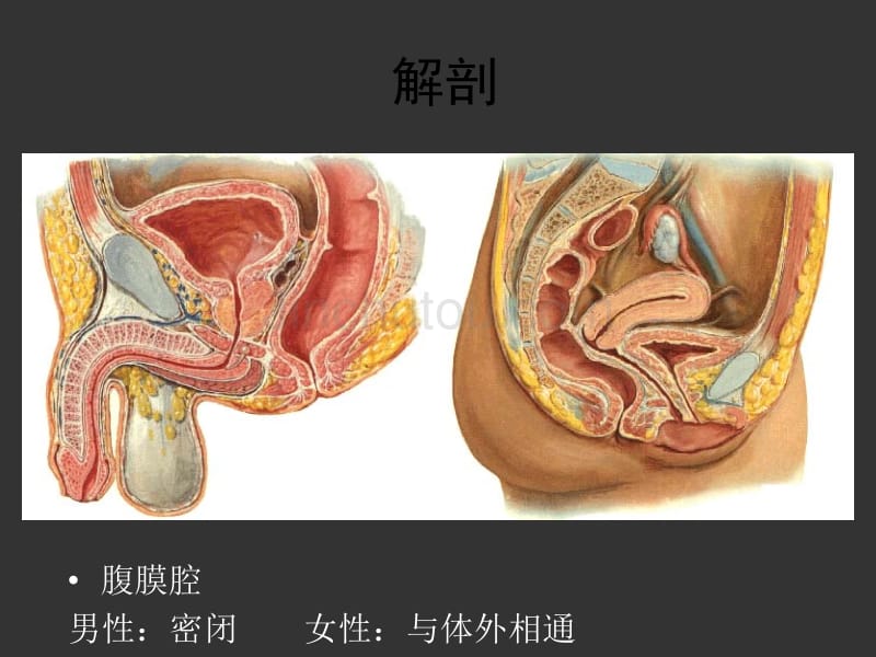 05-急性化脓性腹膜炎幻灯片_第5页