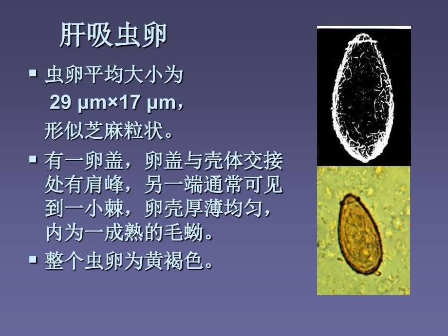 华支睾吸虫课件_第5页