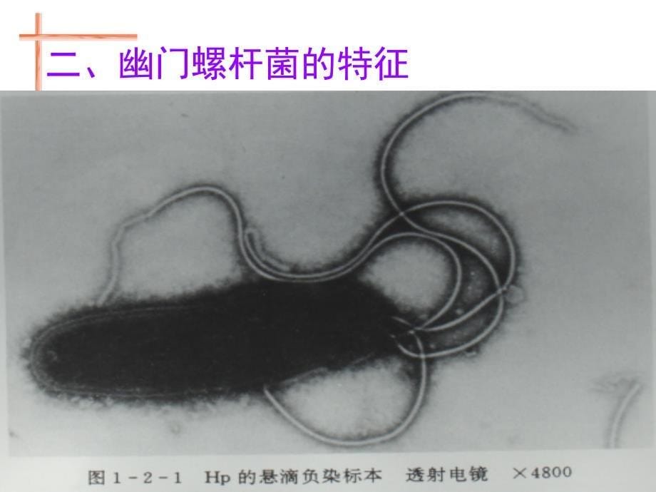 幽门螺杆菌感染与治疗_第5页
