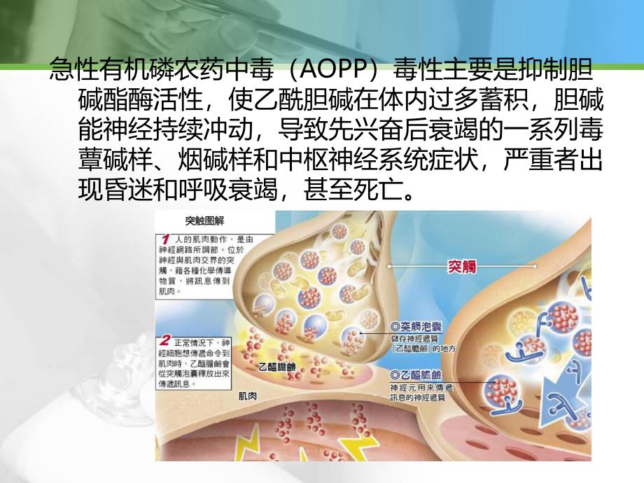 急性有机磷中毒1幻灯片_第2页