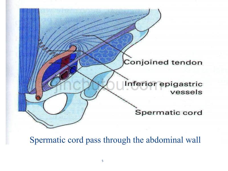 腹外疝ENGLISH幻灯片_第5页