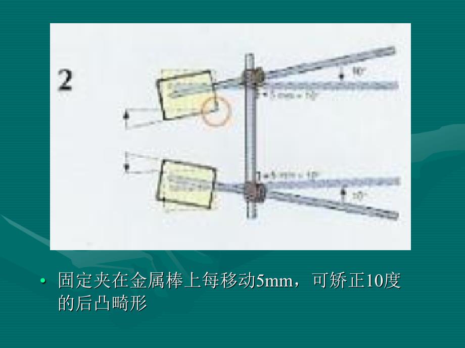 AO-spine 操作图解_第3页