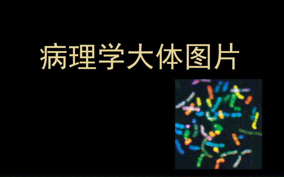 病理学大体图片_第1页