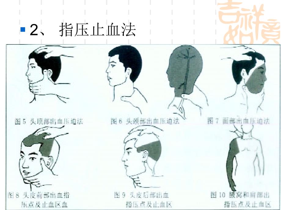 急救常识与保健养生幻灯片_第3页