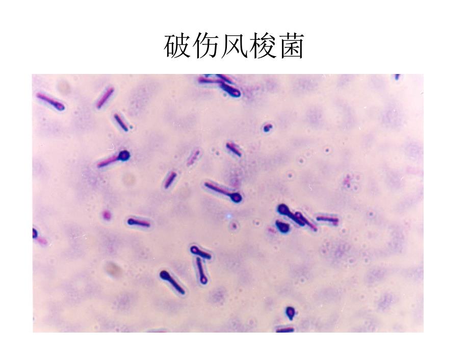 实验十六：厌氧菌_第4页