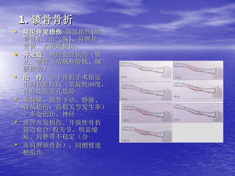 骨折与脱位-诊断分型及治疗一_第3页