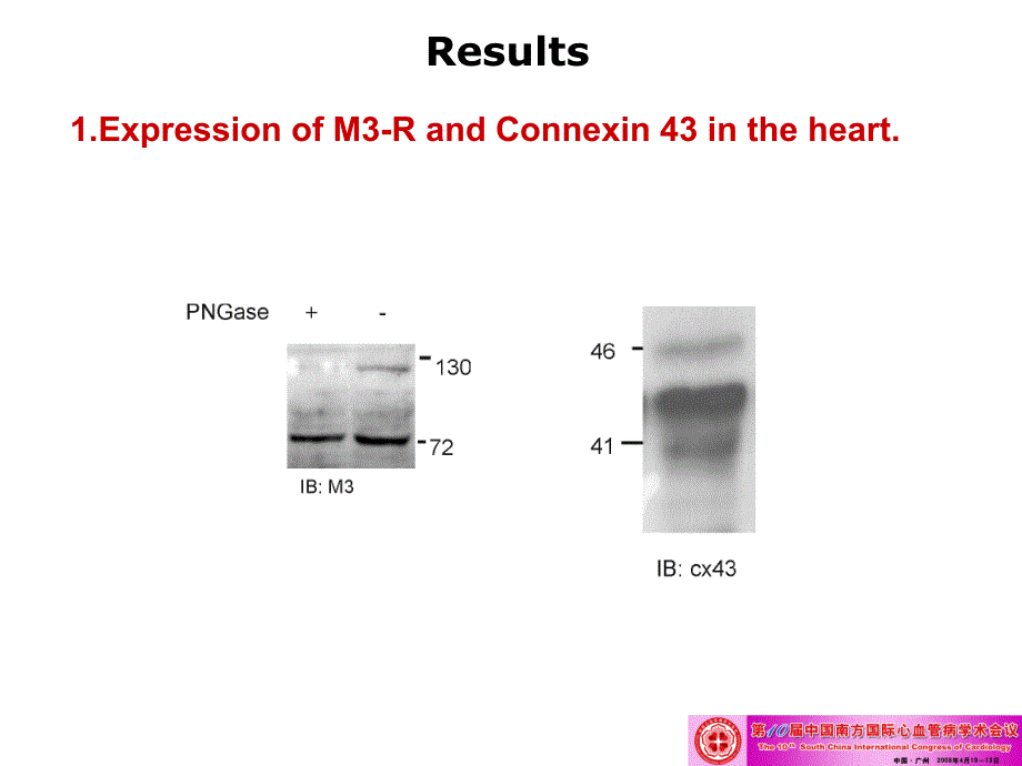 缺血对心肌中连结蛋白43和乙酰胆碱m受体亚型m3 (m3-machr)结合的影响_第4页