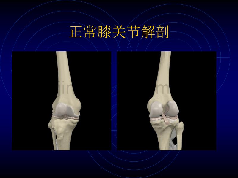 膝关节损伤常用检查法_第3页
