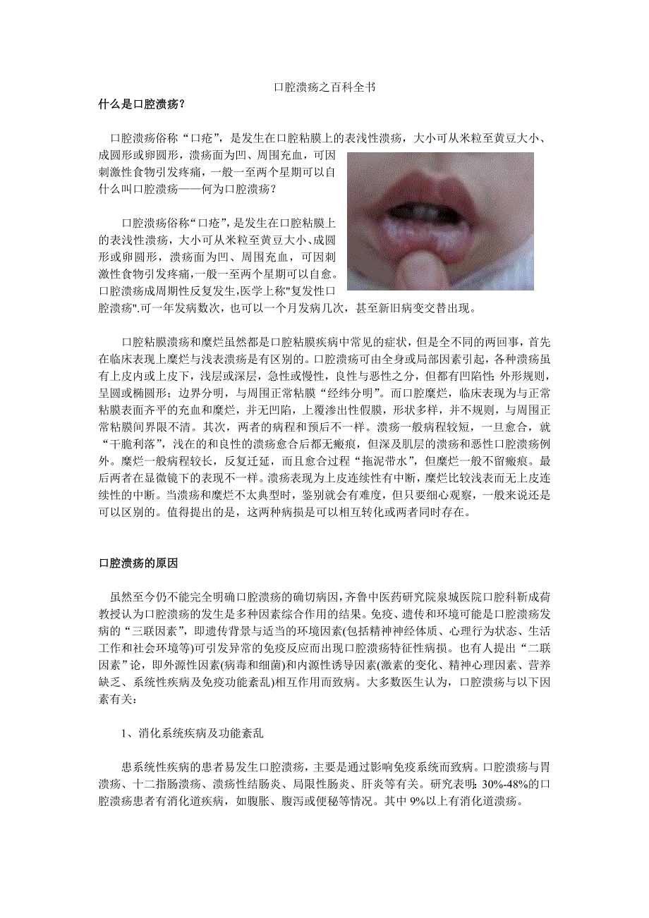 口腔溃疡治疗方法大全--百科全书_第1页
