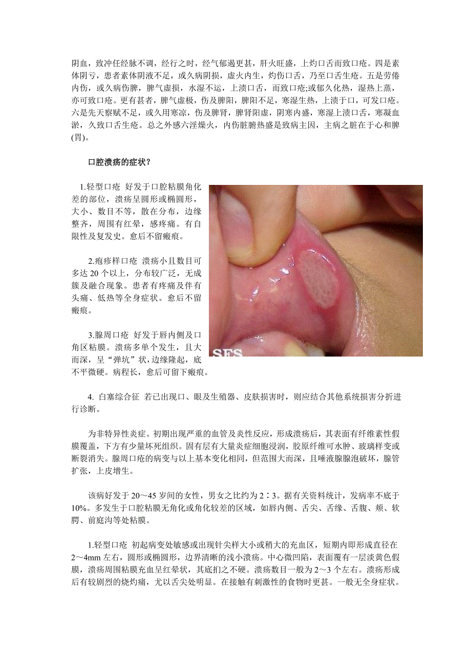 口腔溃疡治疗方法大全--百科全书_第3页