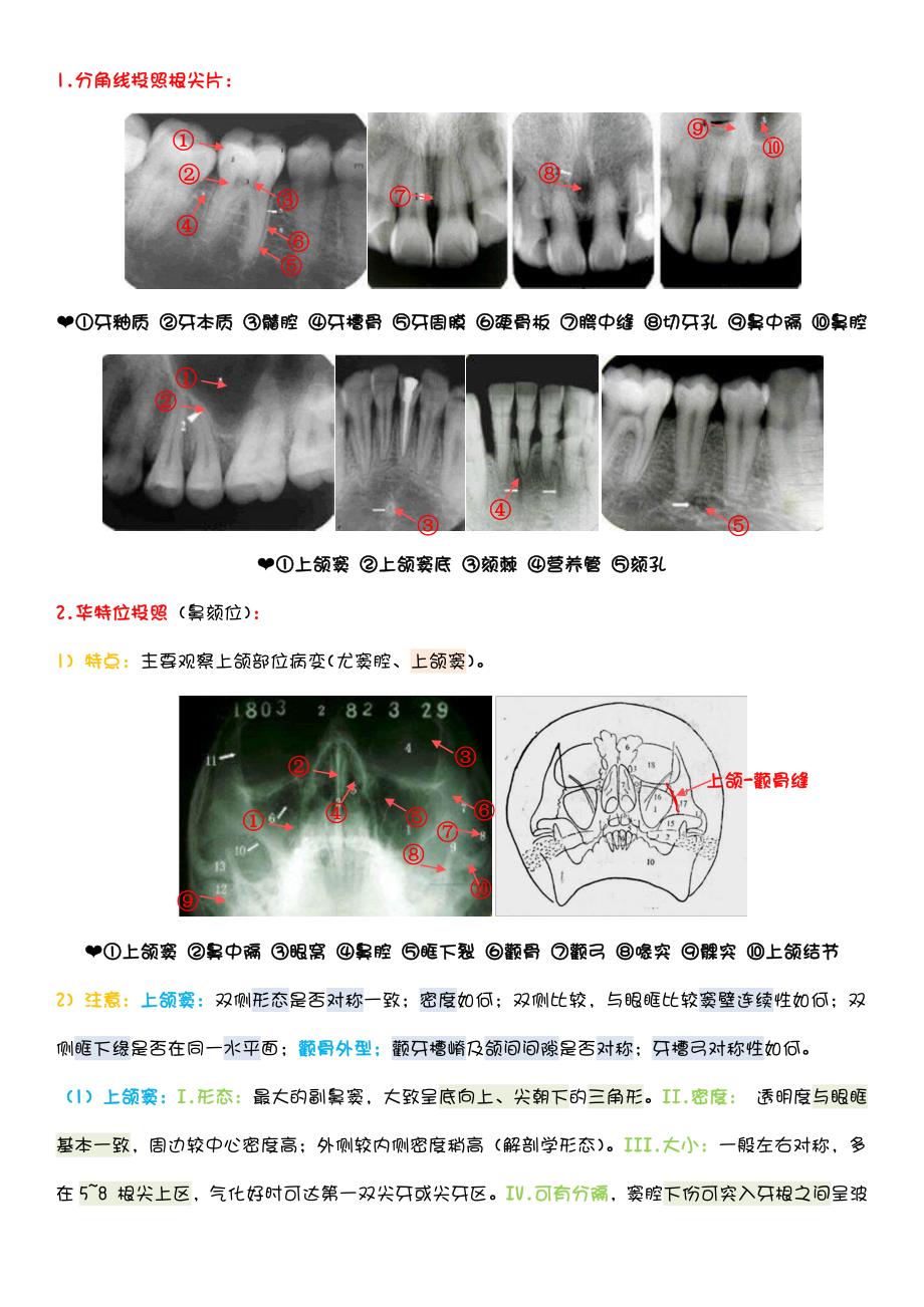 口腔 颌面影像 诊断_第2页
