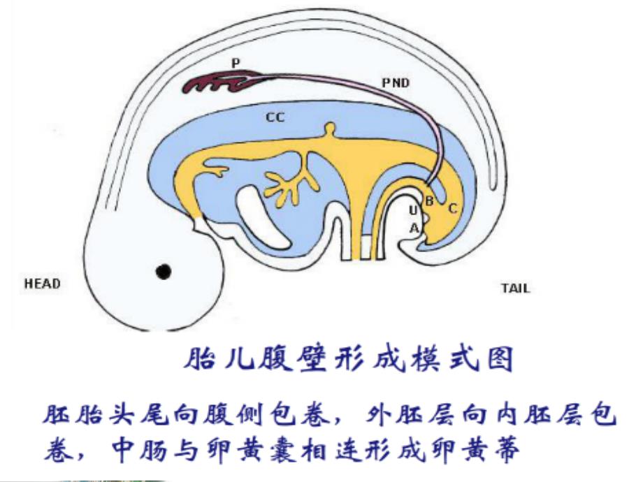 胎儿前腹壁畸形超声诊断_第3页