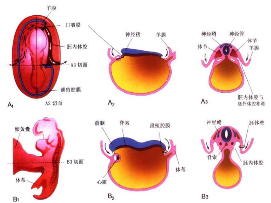 胎儿前腹壁畸形超声诊断_第4页