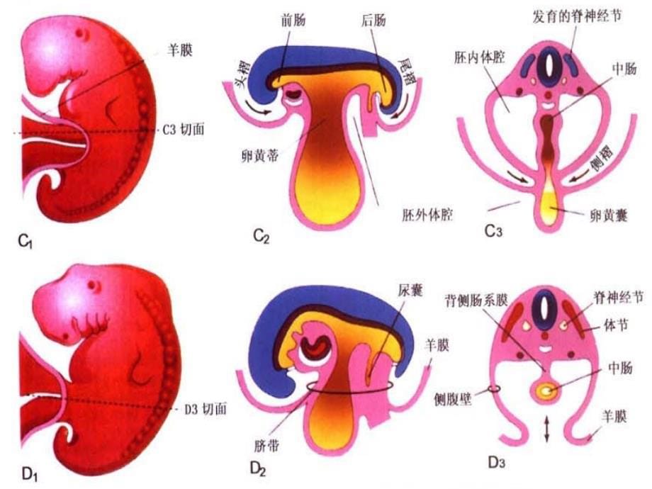 胎儿前腹壁畸形超声诊断_第5页