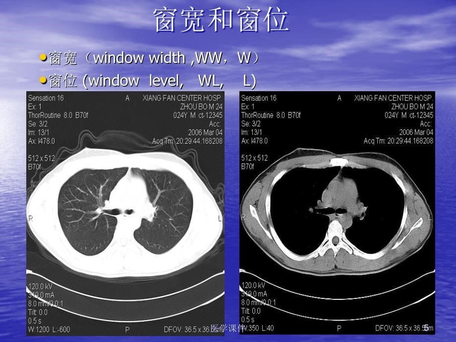 CT基础知识 PPT课件_第5页