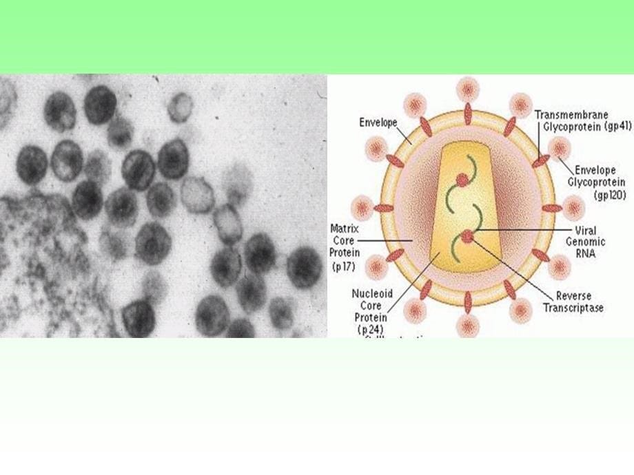 [医学微生物学]逆转录病毒_第5页