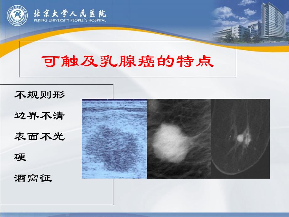 乳腺癌的早期诊断_2015_第4页