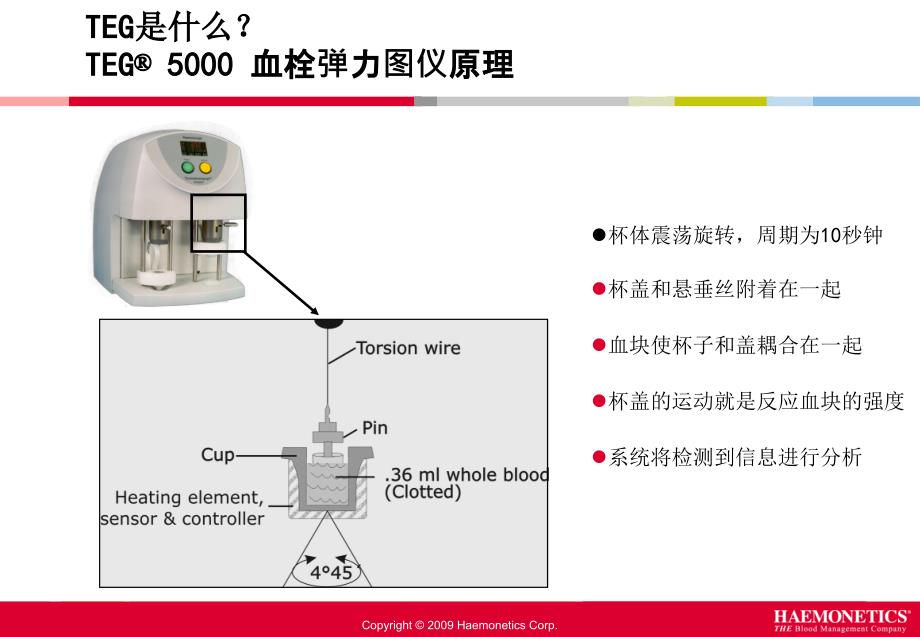 新医三附院输血科TEG培训_第4页