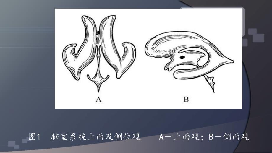 脑室引流术ppt课件_第4页