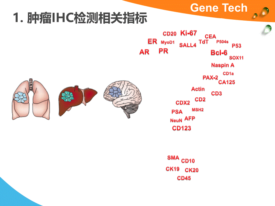 肿瘤IHC检测相关指标--淋巴造血系统疾病_第2页