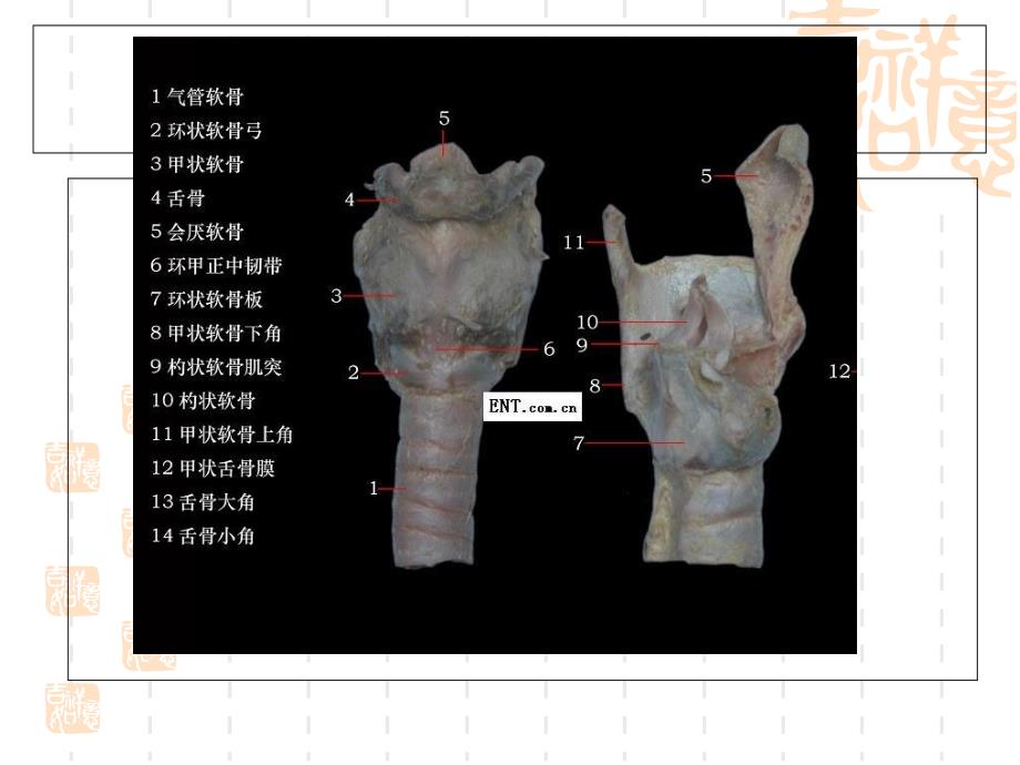 环杓关节脱位精要_第4页