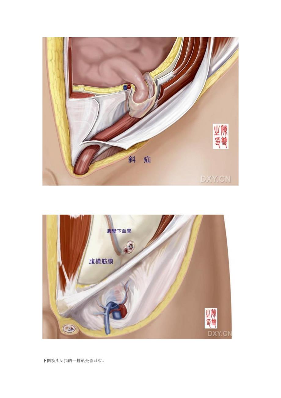 腹股沟区域的解剖与疝修补术_第4页