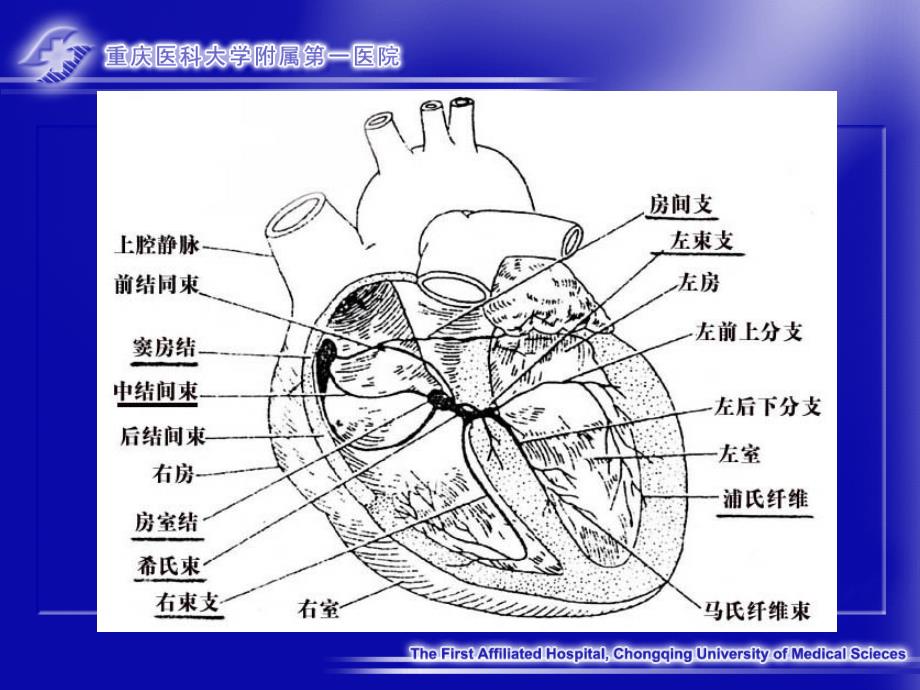 异常心电图(重庆医科大学临床学院心内科)_第4页