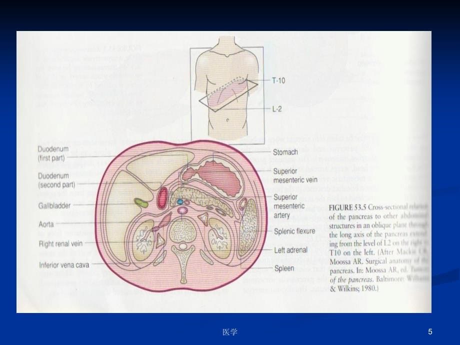 内科学 胰腺疾病(英文) PPT课件_第5页