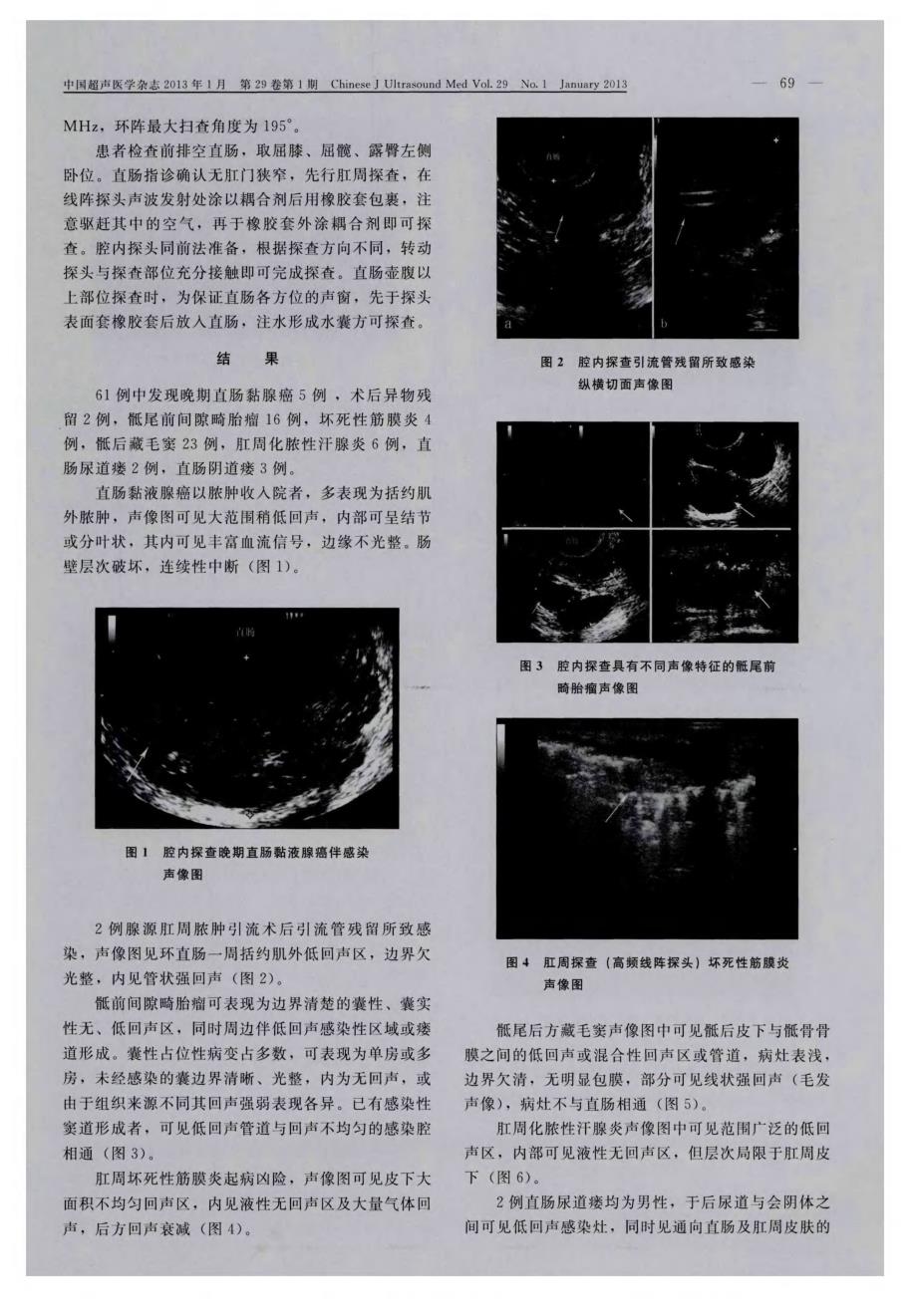 非腺源性以感染为首发症状的肛管直肠及其周围疾病的超声诊断_第2页