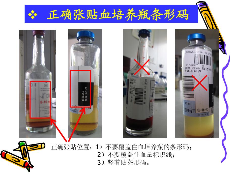 正确采集临床微生物检验标本(下)_第4页