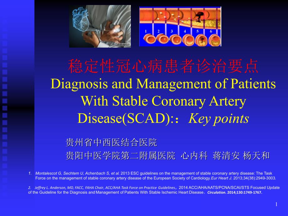 稳定性冠心病诊治要点_第1页