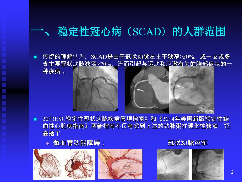 稳定性冠心病诊治要点_第2页