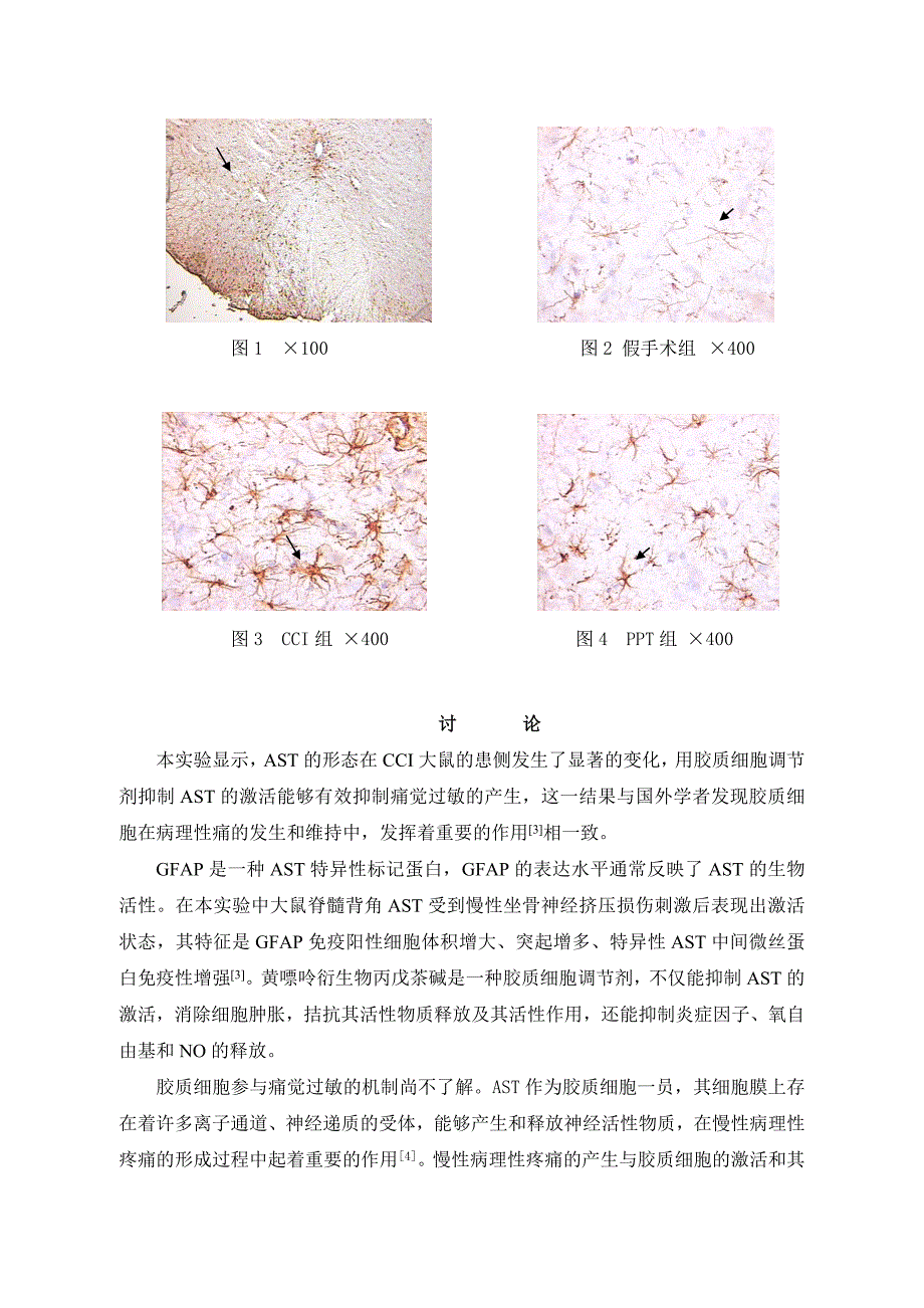 鞘内注射丙戊茶碱对神经痛大鼠脊髓背角星形胶质细胞的..._第4页