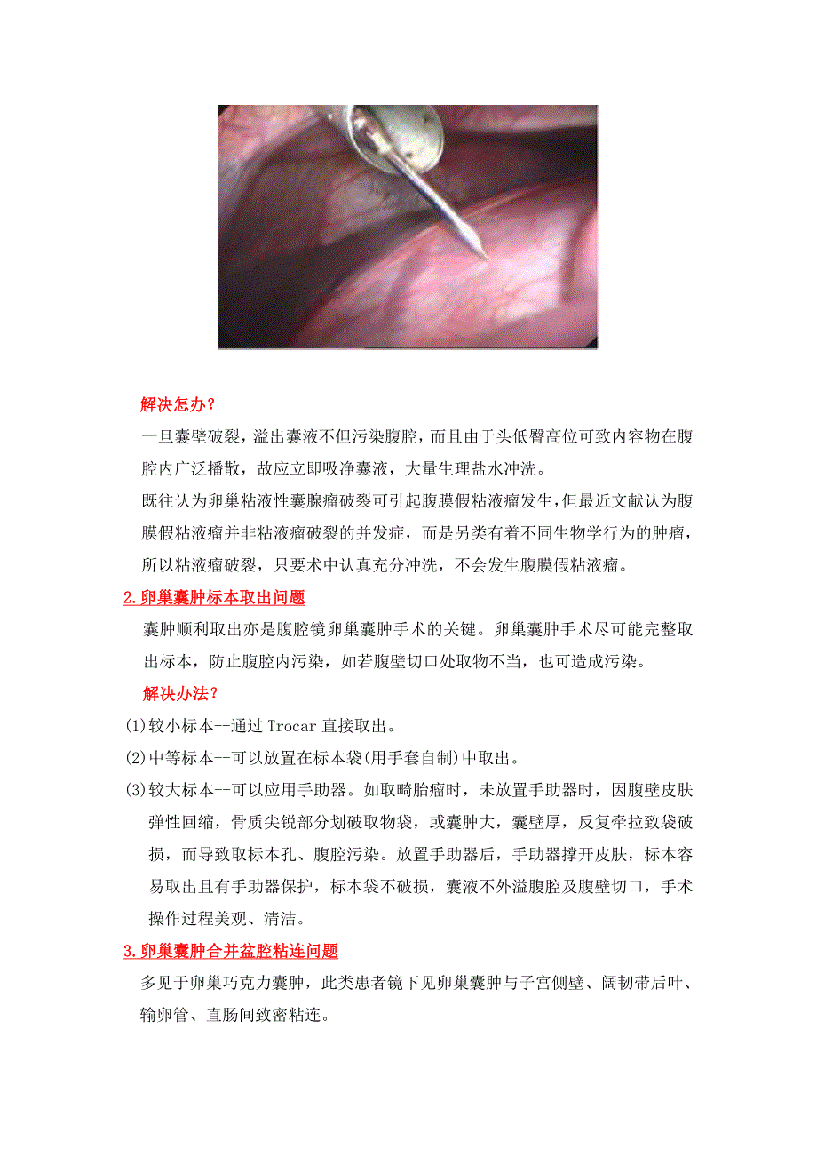 腹腔镜下卵巢囊肿剥除术_第4页