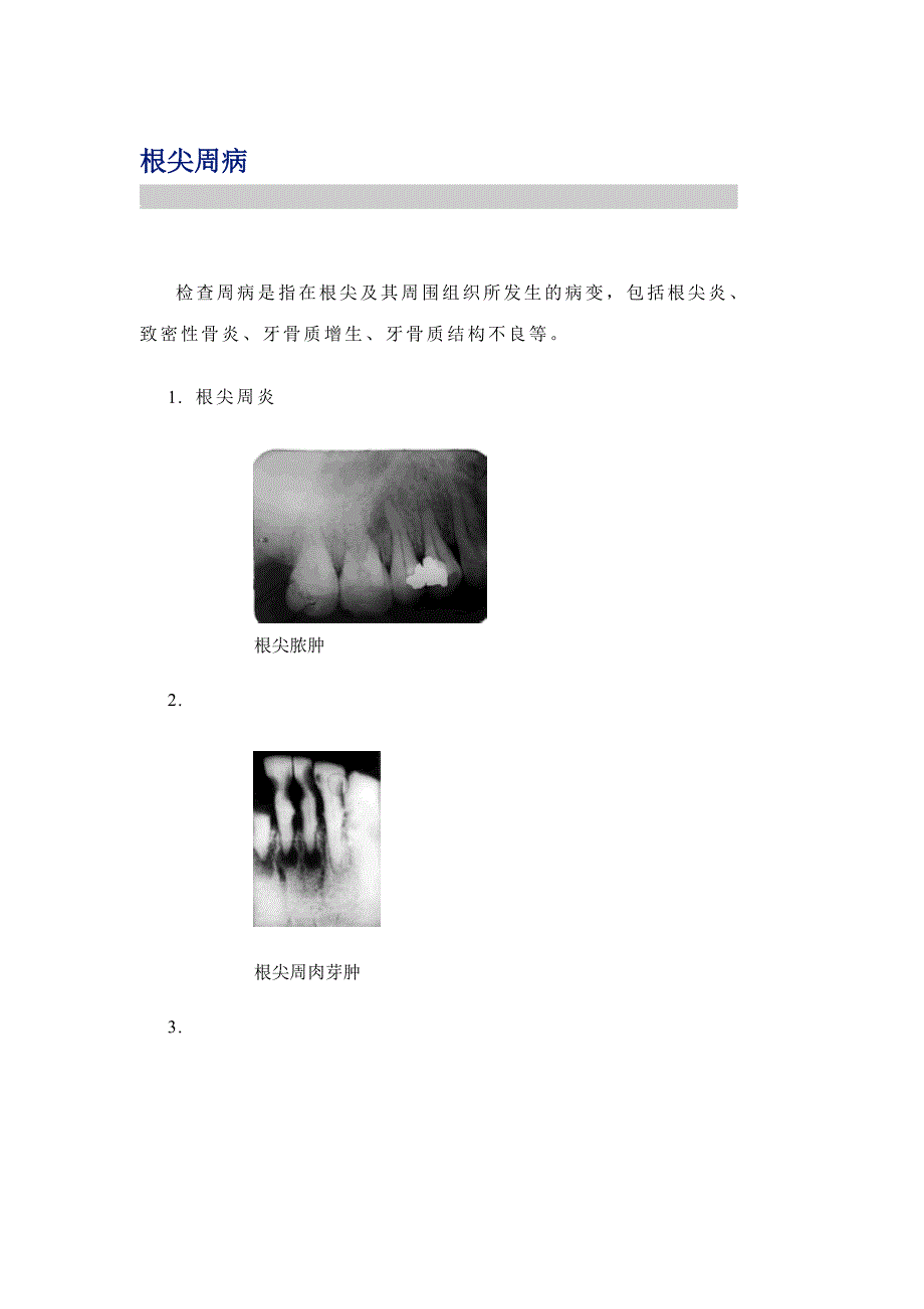 龋病,牙髓病,根尖周病,牙周炎,牙外伤,牙根折断_第4页