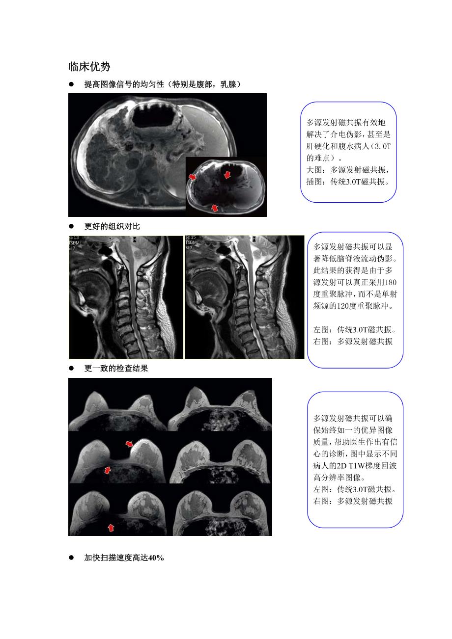 飞利浦全新achieva 3.0t tx多源发射磁共振特点介绍_第2页