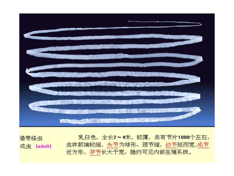 医学蠕虫--绦虫_第4页