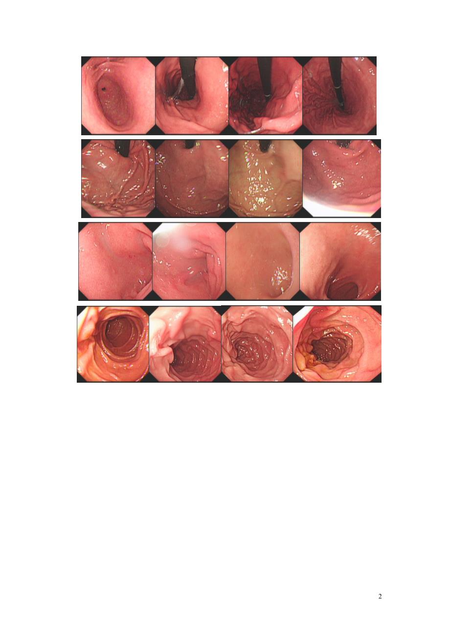 高清胃镜图像-学习利器_第2页