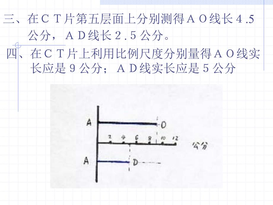 颅内血肿CT片定位_第4页