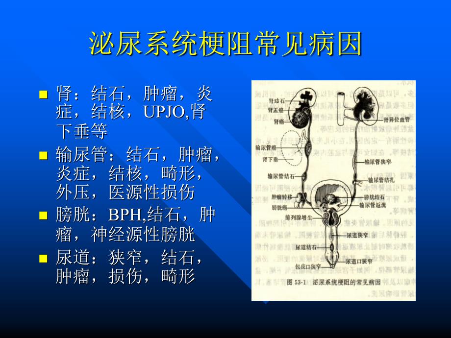 泌尿系统梗阻7幻灯片_第3页