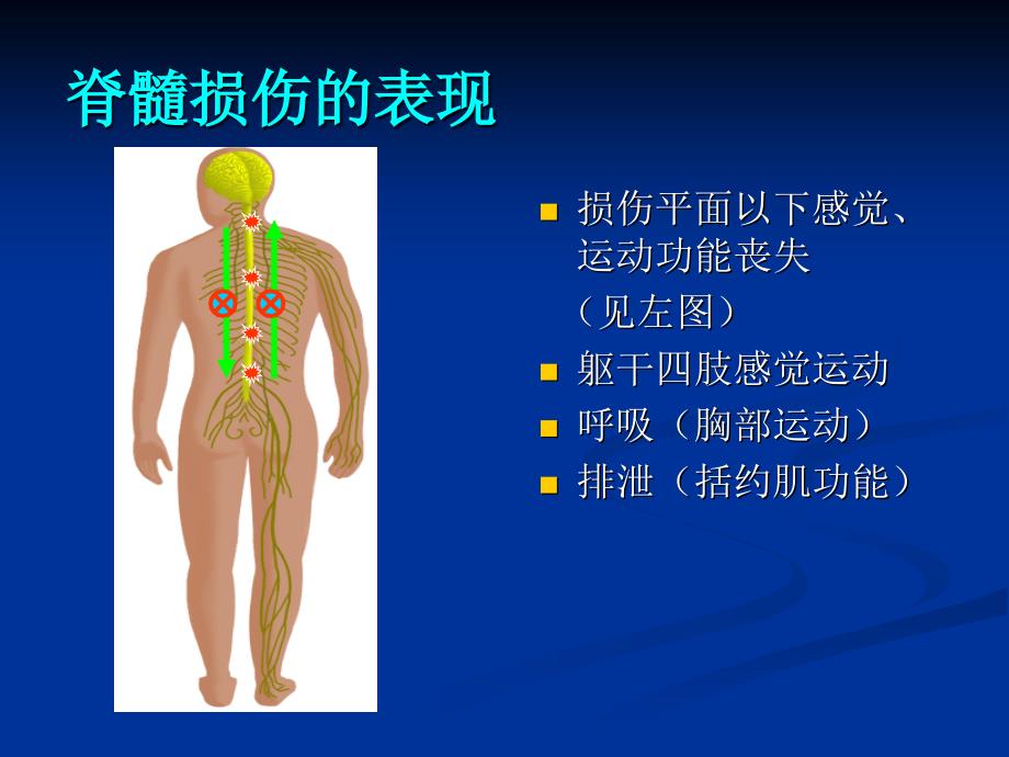 脊柱脊髓损伤的临幻灯片_第3页